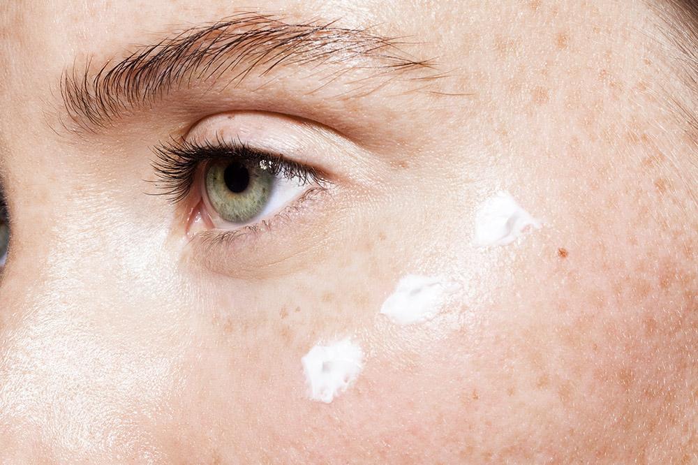 10 Natural Ways To Get Rid Of Bags Under The Eyes